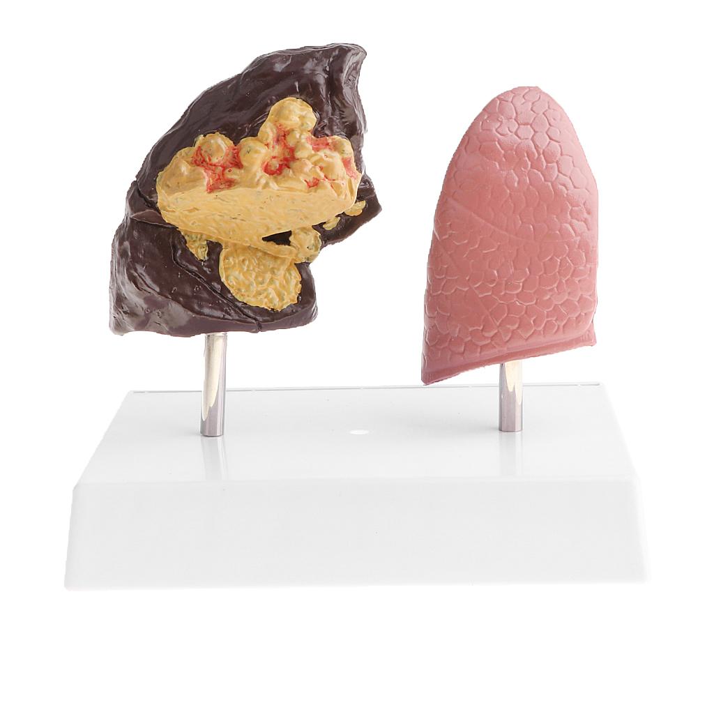 Medical Lab Supplies - Human Lung Normal Comparison Model PVC