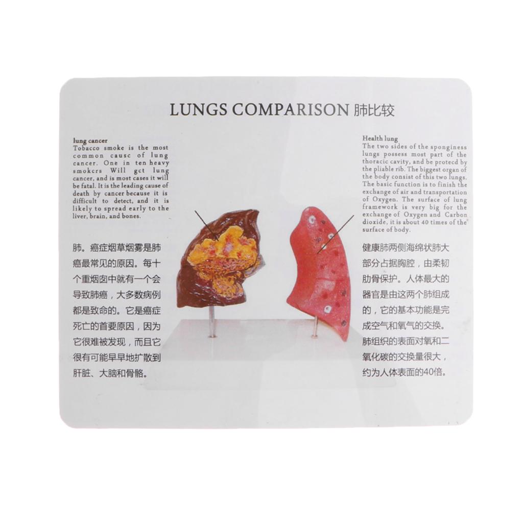 Human Lung Normal Comparison M - Medical Lab Supplies 评论和价格